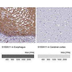 S100A11 Antibody, Novus Biologicals 0.1mL; Unlabeled:Antibodies, Polyclonal